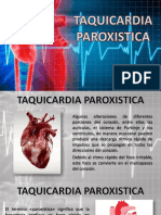 Taquicardia Paroxistica