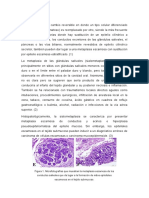 Patogenia de Metaplasia Escamosa en Boca