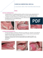Fotos Clinicas Medicina Bucal:: Tema 1. Lesiones en La Mucosa Oral Por Agentes Mecánicos Y Químicos