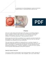 Cervical Insufficiency:: Miscarriage Early (Premature)