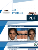 Eye Prosthesis: by G. Vineeth Iii Mds