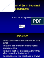 Small Bowel Neoplasms