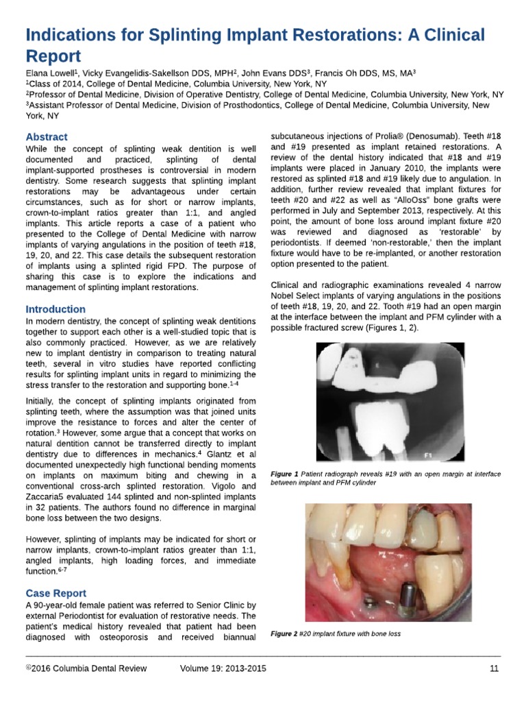 Indications For Splinting Implant Restorations PDF Dental Implant