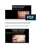 Saúde periodontal e diagnóstico da doença