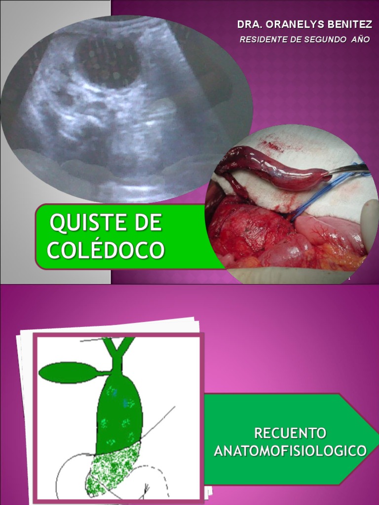 Quiste_de_Coledoco[1] Enfermedades digestivas Sistema exocrino