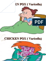 Chicken Pox ( Varicella)2