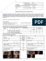 K213- WIN-KAYA- ODS Katarak Kortikal + Subkapsular Posterior (C4P3) 