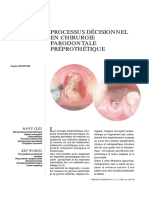 Processus décisionnel en chirurgie parodontale préprothétique