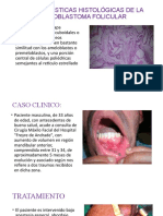 Características Histológicas de La Ameloblastoma Folicular Sthe
