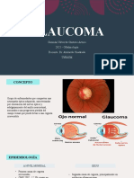 El glaucoma: factores de riesgo, diagnóstico y tratamiento