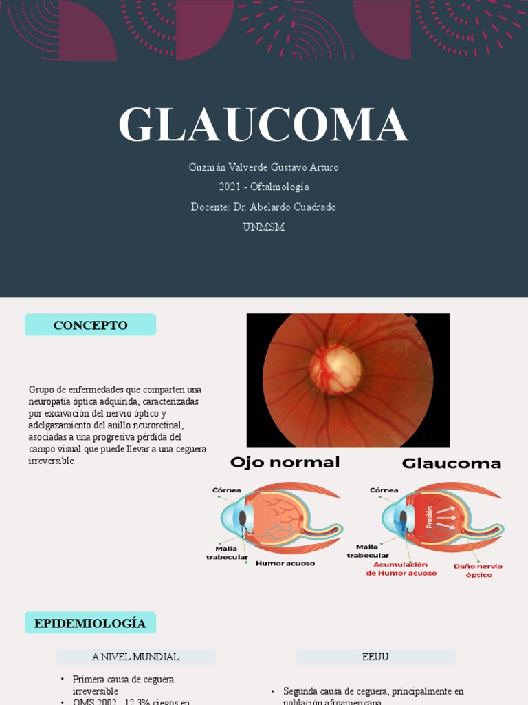 Glaucoma: Diagnóstico y Tratamiento | PDF | Glaucoma | Medicina CLINICA