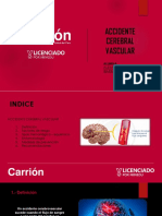 Accidente Cerebrovascular - Alexa