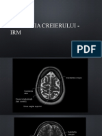 Anatomia creierului - IRM 
