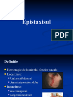 02 Epistaxis