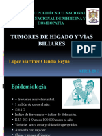 Tumores de Hígado y Vías Biliares