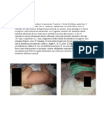 Caso clínico de mielomeningocele lumbosacro en recién nacida
