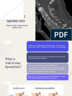 Ankylosing Spondylitis Presentation