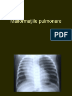Pulmonar Malf Inflamatii Stud LP 2020