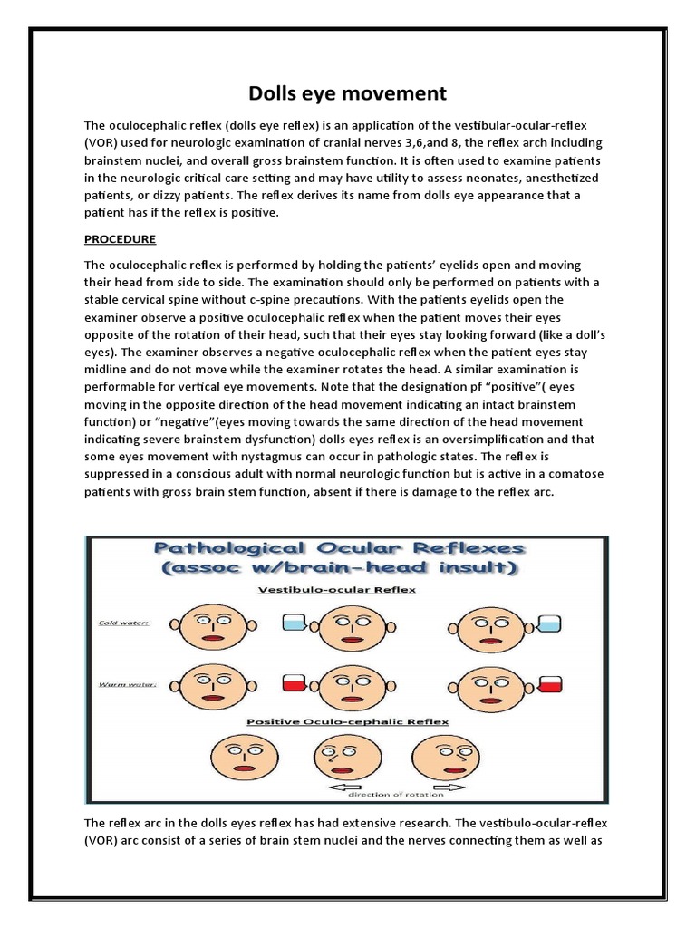Dolls Eye Movement PDF Vestibular System Nervous System