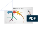 coronary prx mid distal