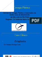 Caso Clínico Zetaplastia