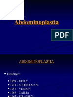 Abdominoplastia 