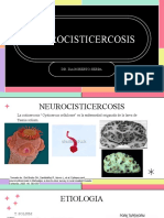 Neurocisticercosis ML