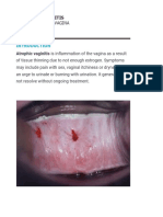 Inflammation of Vagina: Atrophic Vaginitis 15 JUNE, 2020