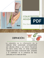 Colecistitis aguda: causas, síntomas y tratamiento