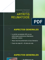 Artritis Reumatoide.