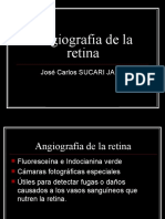 Angiografia de La Retina