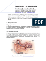 Implante Coclear y rehabilitación