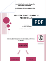 MASTECTOMIA