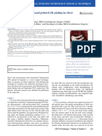 Customized 3-Dimensional Printed Rib Plating in Chest Wall Reconstruction