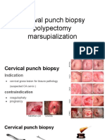 Cercival Punch Biopsy Polypectomy Marsupialization