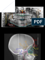 Practica RADIOGRAFICA