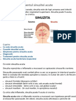 Cauzele si tratamentul sinuzitei acute