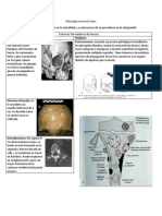 Patología Tumoral Ósea