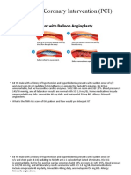 Percutaneous Coronary Intervention (PCI)