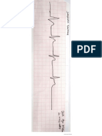 Tugas Intepretasi EKG_ Diah Ayu Pitaloka_20.0603.0085