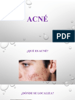 ACNÉ