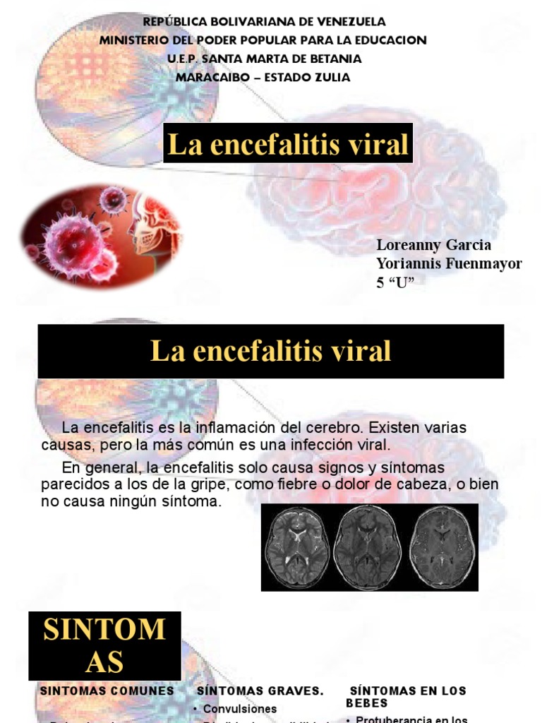 Encefalitis Viral | PDF | Virus | Infección