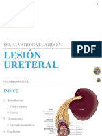 Lesion Ureteral