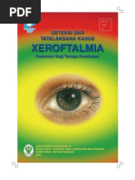 Download xeroftalmia by Ravani Monika SN57443734 doc pdf