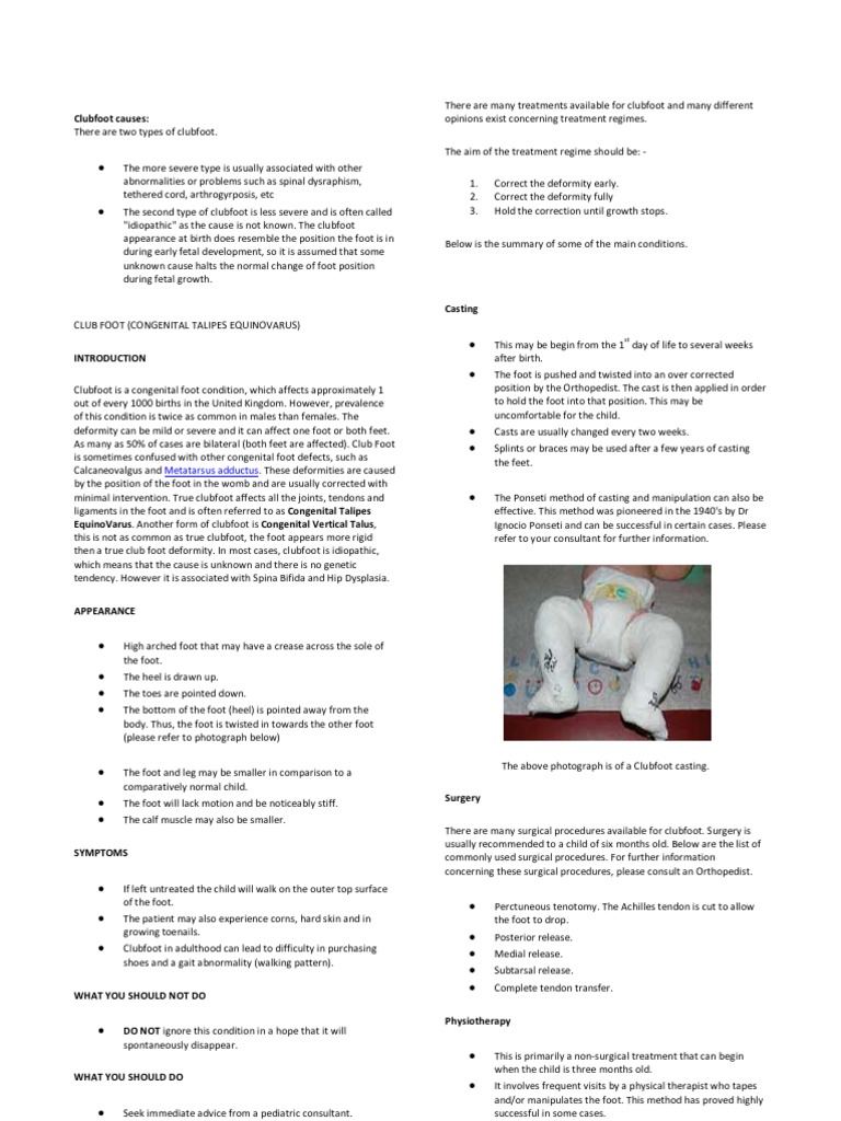 Clubfoot Foot Musculoskeletal System