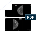 RADIOGRAFIA MAMARIA