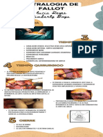 Tetralogia de Fallot Kimberly Boya y Lucia Reyes