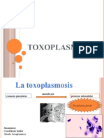 Toxoplasmosis