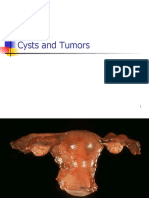 Ovarian Cyst and Tumors