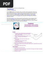 Download Implan by Miela SN57512174 doc pdf